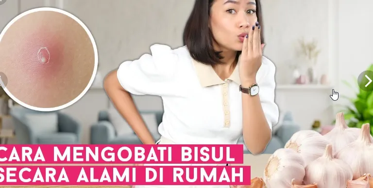 6 Tips Jitu Mengobati Bisul Agar Cepat Kempes